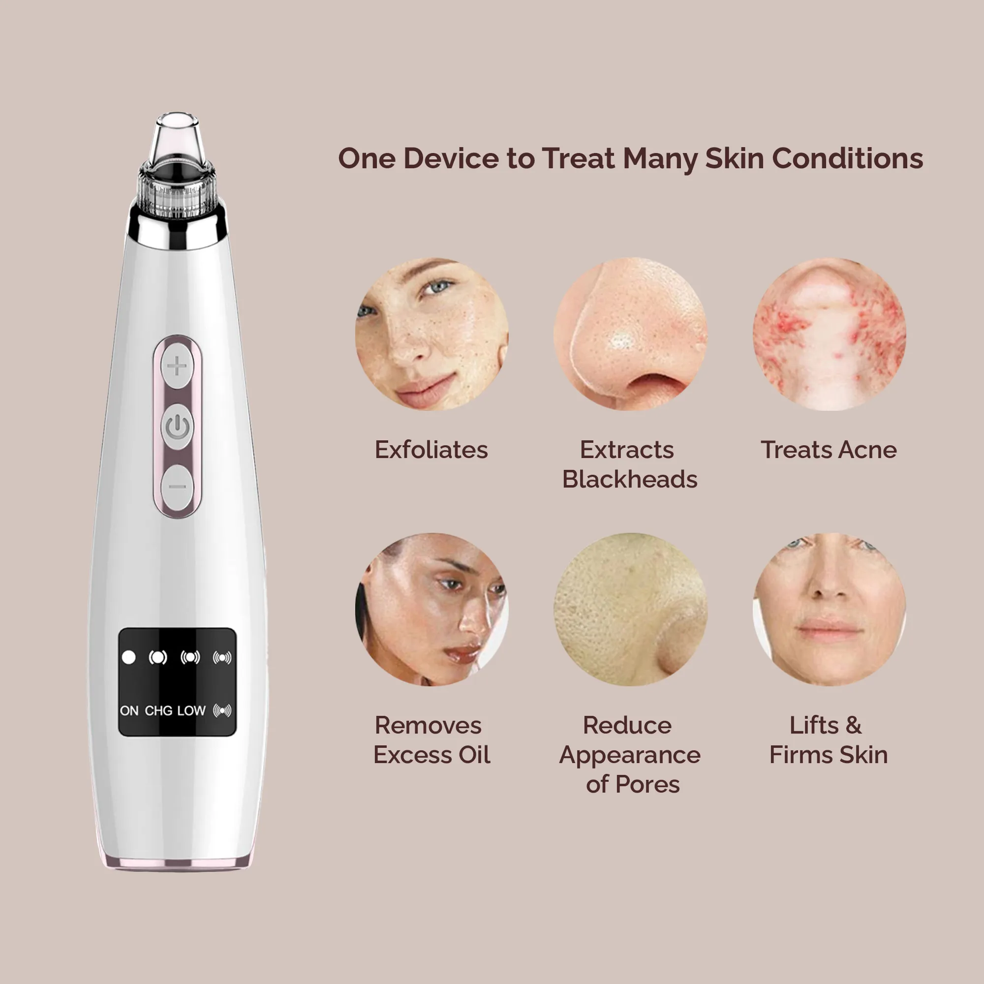 Electric Blackhead Remover, Pore Cleaner, & Facial Combo